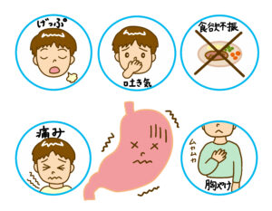 胸やけ・げっぷ・のどの違和感…胃カメラを受けるべき症状は？
