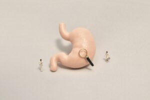 胃カメラ（上部消化管内視鏡検査）が怖い方へ