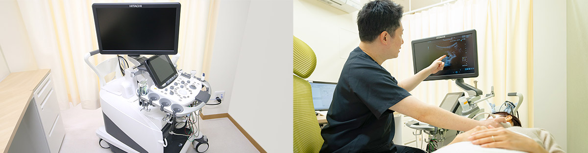 超音波診断装置