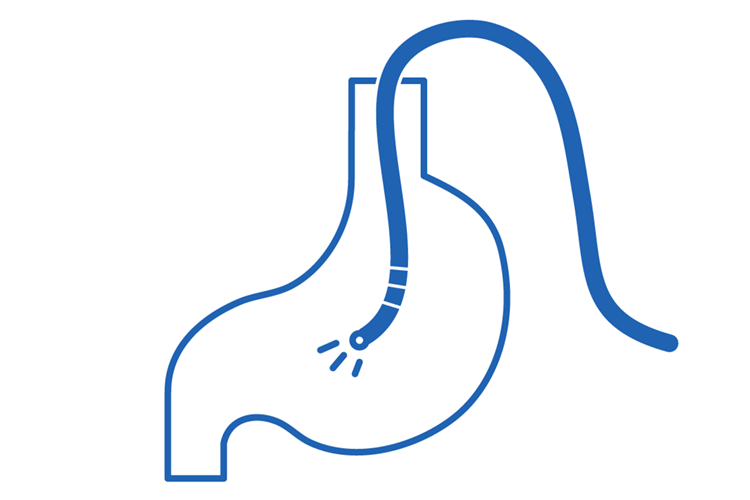 STEP4. 食道、胃、十二指腸を観察