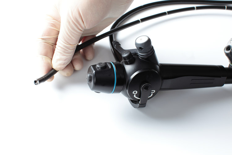 胃カメラ（上部消化管内視鏡検査）のイメージ画像