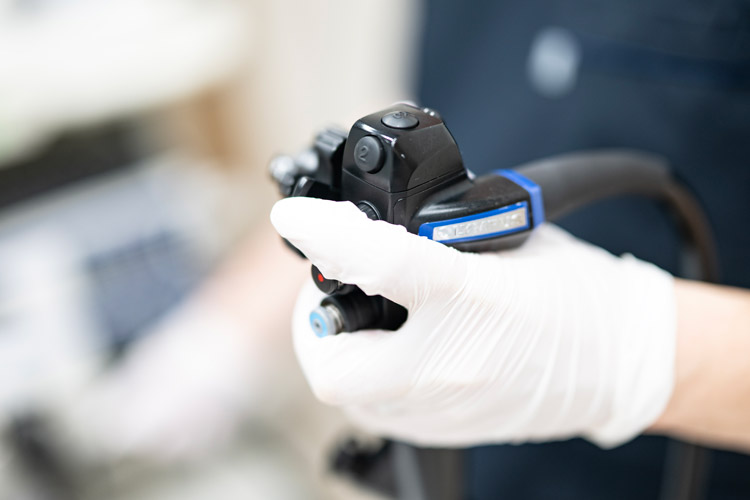 胃カメラ（上部消化管内視鏡検査）のイメージ画像