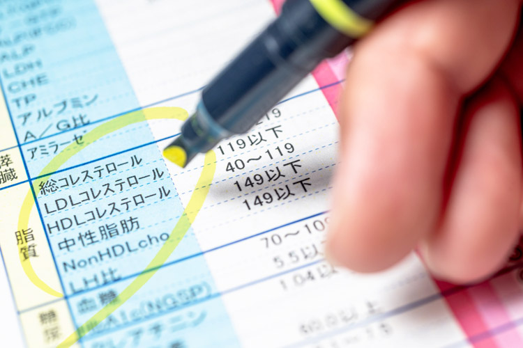 脂質異常症（高脂血症）のイメージ画像