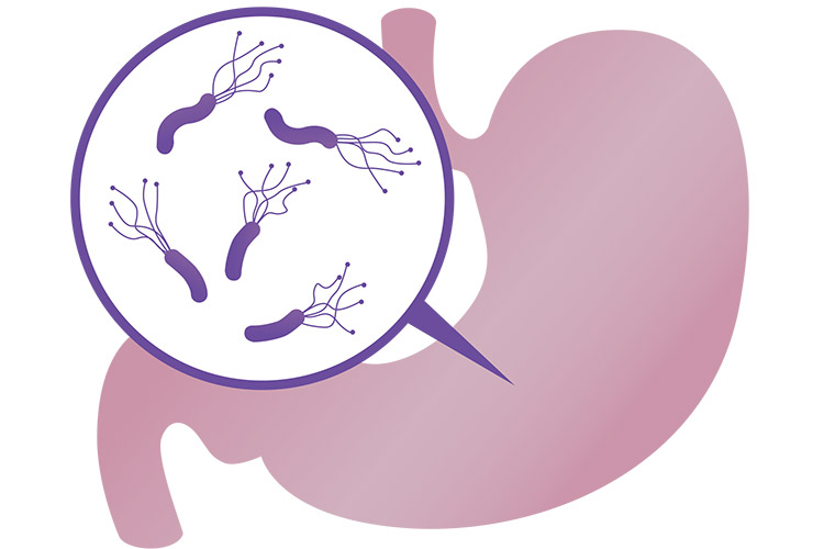 ピロリ菌のイメージ画像